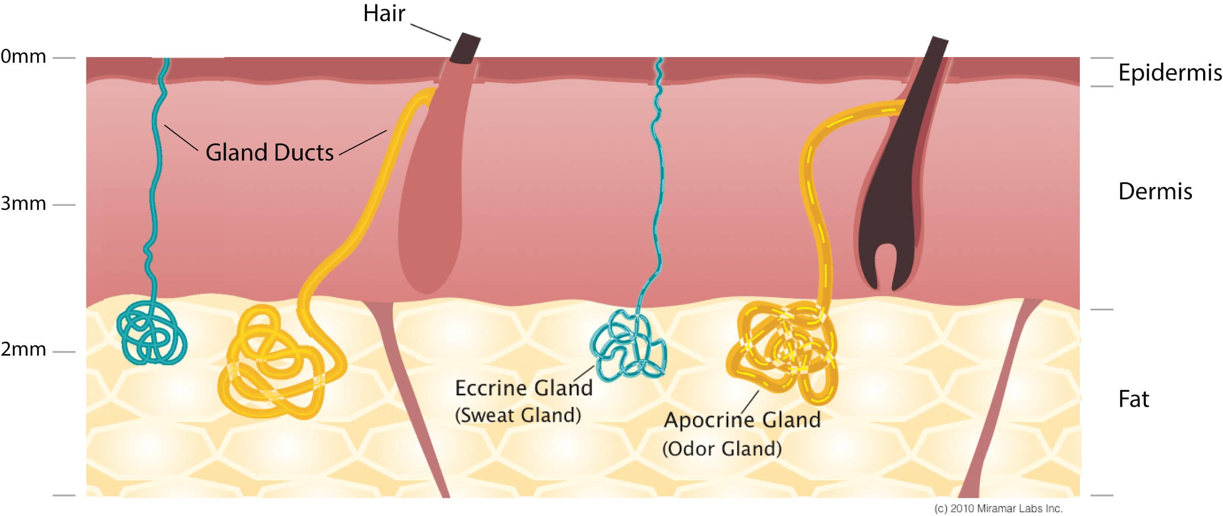 Before treatment with miraDry